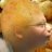 Rumple Foreskin